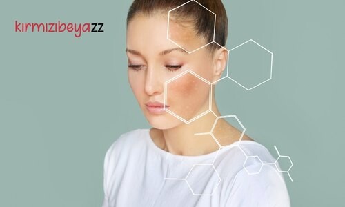 Geniş Gözenekler İçin Bakım Önerileri