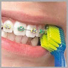 Curaprox CS 5460 Ortho Ultra Yumuşak Diş Fırçası - 2
