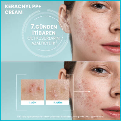 Ducray Keracnyl PP Creme 30 ml - 3