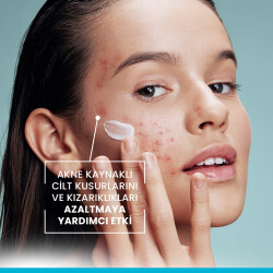 Ducray Keracnyl PP Creme 30 ml - 7