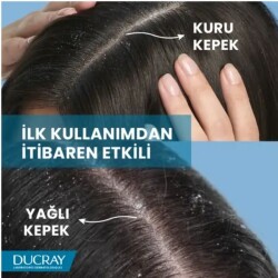 Ducray Squanorm Lotion 200ml - 4