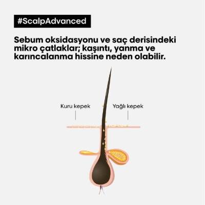 Loreal Professionnel Serie Expert Scalp Advanced Yağlanma Karşıtı Şampuan 500 ml - 4