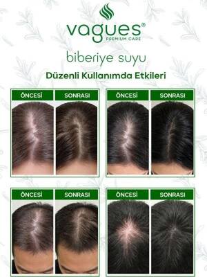 Vagues Biberiye Suyu Dökülme Karşıtı Saç Toniği 100 ML - 3